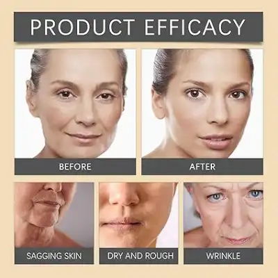 OUHOE Bee Venom Wrinkle Cream – Hydrating & Firming Anti-Aging Moisturizer - Image 9